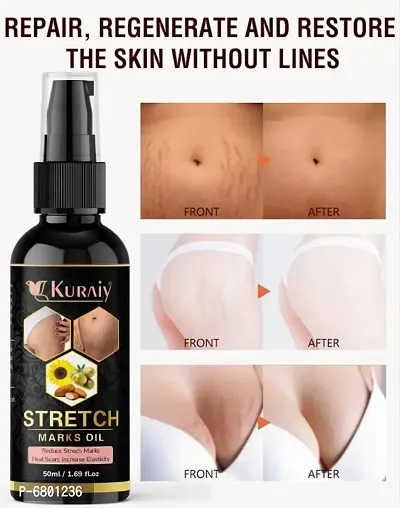 Kuraiy Natural Stretch Oil with Coconut, Olive  Jojoba Oils, For Scars  Stretchmark Oil-thumb0