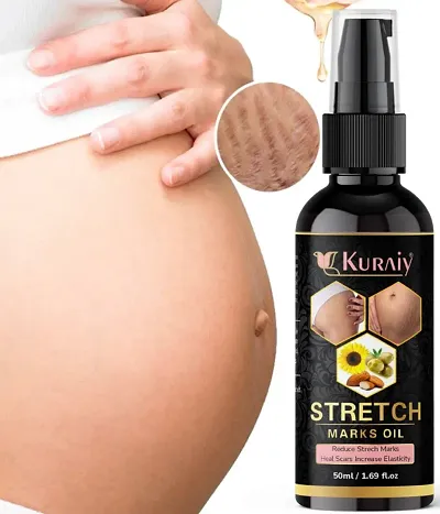 Kuraiy Stretch Oil For Stretch Marks Removal Post Pregnancy Fast Work 100% Result Stretch Mark Cream Oil