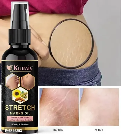 Kuraiy stretch Oil for Stretch Marks Removal Post Pregnancy fast work 100% result stretch mark cream oil  (50 ml)-thumb0