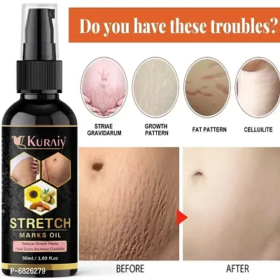 Kuraiy stretch Oil for Stretch Marks Removal Post Pregnancy fast work 100% result stretch mark cream oil  (50 ml)