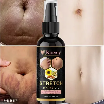 Buy Kuraiy Natural Stretch Oil with Coconut, Olive Jojoba Oils, For Scars  Stretchmark Oil Online In India At Discounted Prices