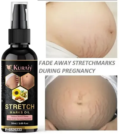 Kuraiy stretch Oil for Stretch Marks Removal Post Pregnancy fast work 100% result stretch mark cream oil  (50 ml)