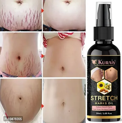 Kuraiy Natural present Repair Stretch Marks Removal Cream - Natural Heal Pregnancy Breast-thumb0