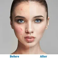 KURAIY Salicylic Acid 2% Masque Formulated Deep Cleansing Face mask 100ML-thumb4