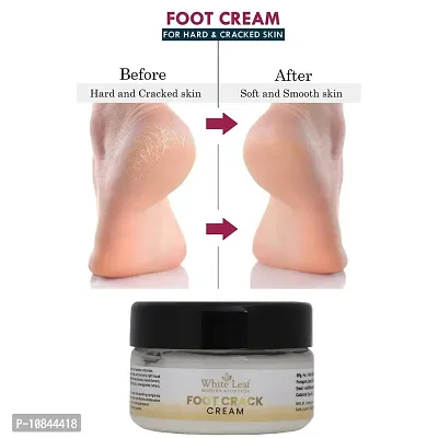 White Leaf Crack Foot Creams  Lotions (50gm)