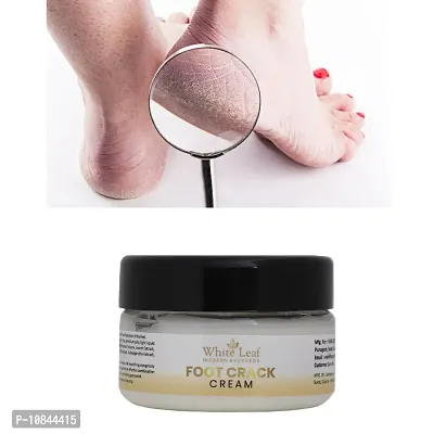 White Leaf Foot Crack Scrub For Dry Cracked Heels  Foot Cream (50gm)