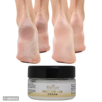 White Leaf Heel, Finger Healing Balm and Crack Blaster Revive Dry Skin and Body Cream (50gm)