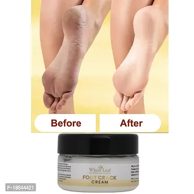 White Leaf Crack Cream For Dry Cracked Heels  Feet 50GM