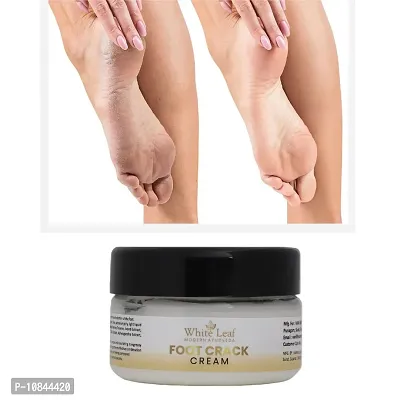 White Leaf | cream for crek heel | creck heel | foot crack creem | foot crem |  (50gm)