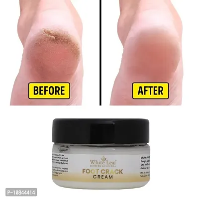 White Leaf Foot Crack Cream For Dry Crack Blaster Revive Heels  Feet (50gm)