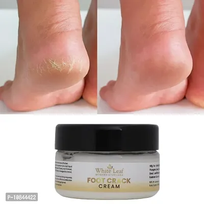 White Leaf Foot Cream Crack Peeling Repair Anti Dry Skin Remove Dead Skin Foot Moisturizing  (50gm)