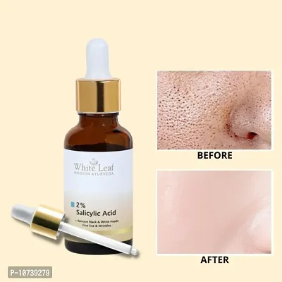 White Leaf Salicylic Acid Face Serum For Acne  Blackheads  Open Pores - 40 Ml | Reduces Excess Oil-thumb0