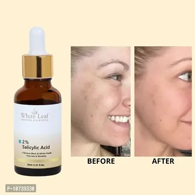 White Leaf 2%Salicylic Acid Face Serum - Quick Absorbing - Oil Free - Anti-Aging  (30 Ml)