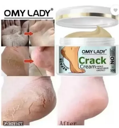 Omy Lady 7 Days Foot Crack Heel Cream (50 g)