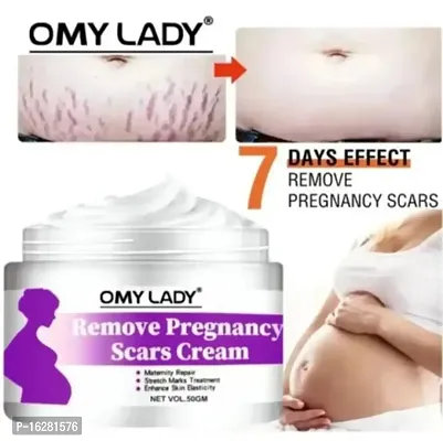 Omy Lady Present Repair Stretch Marks Removal Cream - Natural Heal Pregnancy Breast, Hip, Legs, Mark Cream 50 Gm Pack Of 1