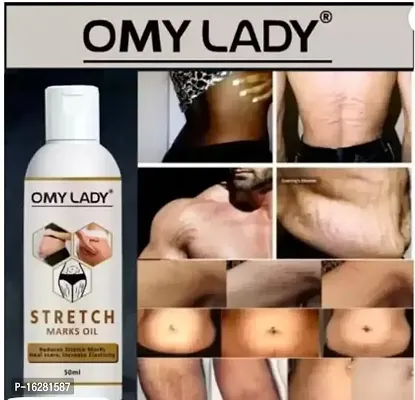 Omy Lady Stretch Marks Removal Oil For Women  Men  (50 ml)