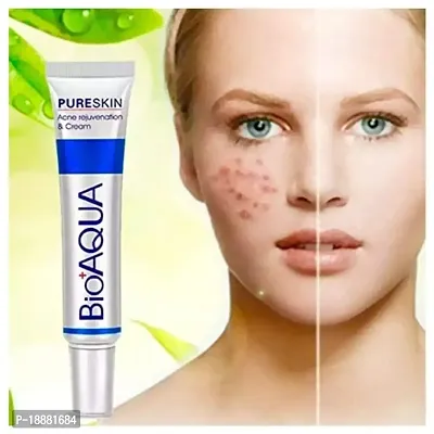 Bioaqua Face Care /Acne Treatment Cream/ Shrink Pores Oil Control Skin Care 30gm