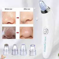 Acne Pimple Pore Cleaner Vacuum tools Facial Cleanser Device for Face, Nose and Skin Care(pack of 1)-thumb2