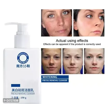 Vitracos Freckle removal Cleanse Helps to provide protection against everydays pollutants- Plant Compound Refreshing Facial Cleanser Face Wash-thumb2