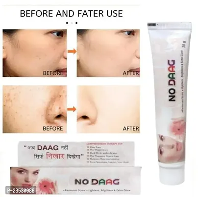 2 PIECES PACK NO DAAG FAIRNESS CREAM ( PACK OF 2 )-thumb3