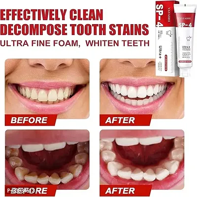 Oral Care Teeth Whitening Toothpaste, 50gm-thumb2