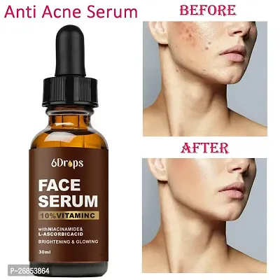 Vitamin C Face Serum With Hyaluronic Acid - Anti Aging Serum - Reduce Dark Spots, Acne And Wrinkles - Niacinamide And Salicylic Acid, Brightening Skin Serum-thumb0