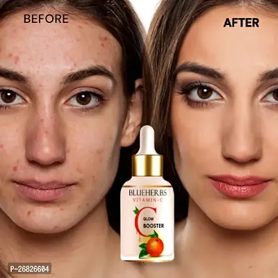Vitamin C Daily Glow Face Serum With Skin Repair, Dark Circle, Dark spot, Fine Line | Face oil, serum for Women  Men