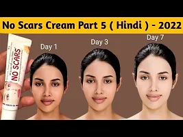 NO SCARS Face Cream to Reduce Scars and Marks 20gm pack of 3 (60-thumb2