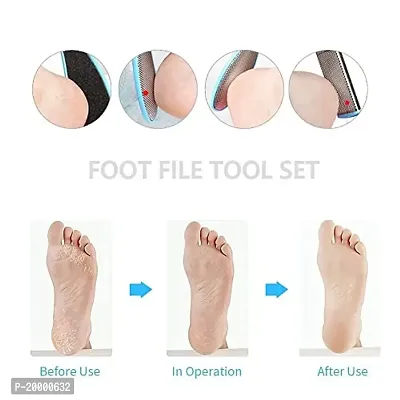 KHUSHI Pedicure Tools for Feet - 8 in 1 Pedicure Kit | Foot Scrubber for Dead Skin, Callus Remover, Foot Scraper, Foot File, Pitchfork, Filer for Nail Repair - 1 Set-thumb2