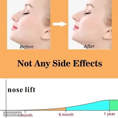 Nose Shaper Lifter Clip Pain-Free Soft Silicone Nose Corrector Nose Bridge Straightener Nose Slimming Device Nose Beauty Up Lifting Tool(Unisex) (Pink)-thumb3