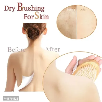 Ftzotof Dry Brush, Dry Brushing Body Brush with Natural Bristles, Exfoliating Brush Body Scrub for Dry Skin, Cellulite Treatment, Lymphatic Drainage and Blood Circulation Improvement, Medium Strength-thumb2