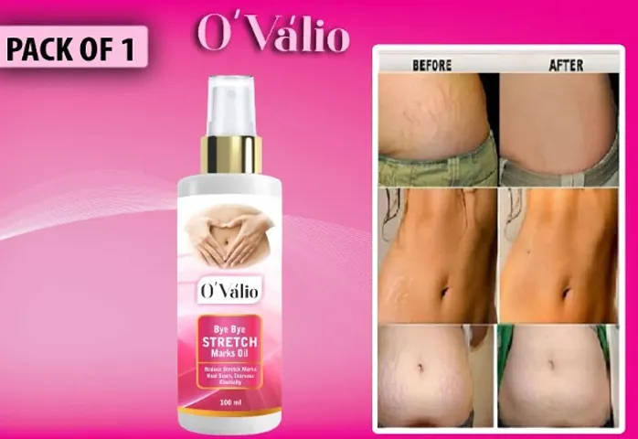 Ovalio Premium Stretch Mark Oil For Men and Women