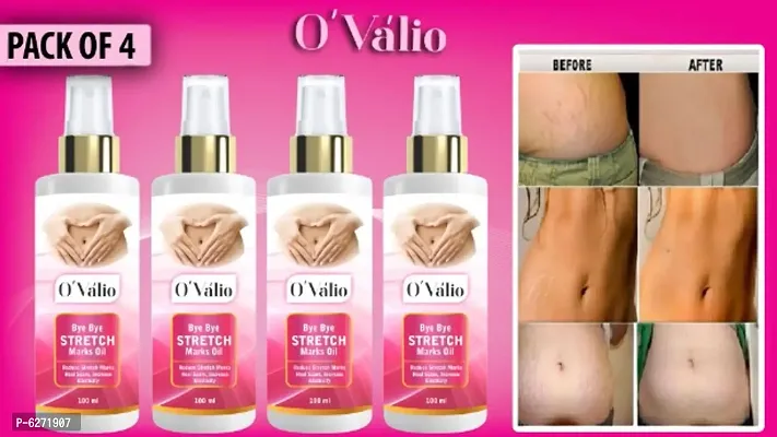 Ovalio Premium Stretch Mark Oil For Men and Women (100ml) Pack Of 4