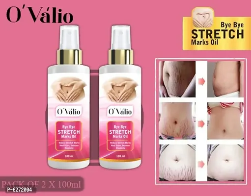 Ovalio Premium Stretch Mark Oil For Men and Women (100ml) Pack Of 2
