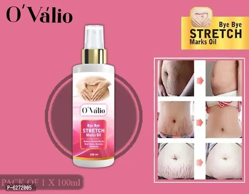 Ovalio Premium Stretch Mark Oil For Men and Women (100ml) Pack Of 1