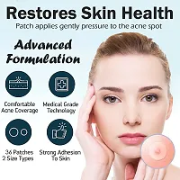 Acne Pimple Patch for Women Men Face Overnight Pimple Healing  36 Waterproof Patches  For Active Surface Acne  Absorbs Pimple Overnight, Reduces Excess Oil | For All Skin Types-thumb1