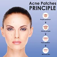 Acne Pimple Patch for Women Men Face Overnight Pimple Healing Acne Patches for Pimples - Effective Protection Against Infection(36 Patches)-thumb2