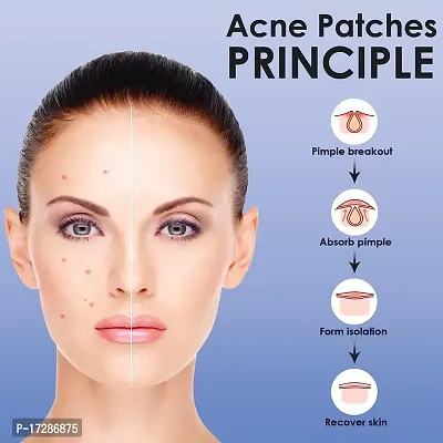 Acne Pimple Patch for Women Men Face Overnight Pimple Healing Acne Patches for Pimples - Effective Protection Against Infection(36 Patches)-thumb3