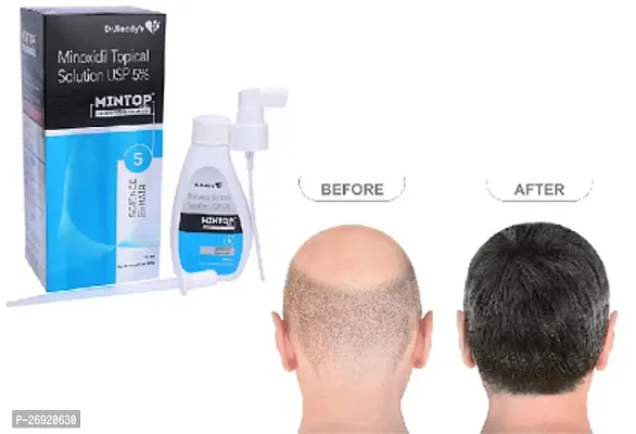 New mintop minoxidil 10% solution pack of 1-thumb0