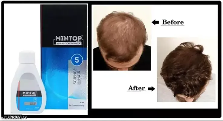 New mintop minoxidil 10% solution pack of 1-thumb0