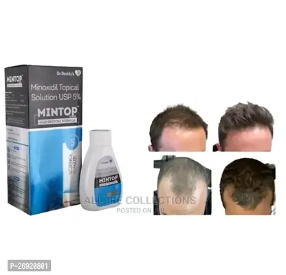 New mintop minoxidil 10% solution pack of 1