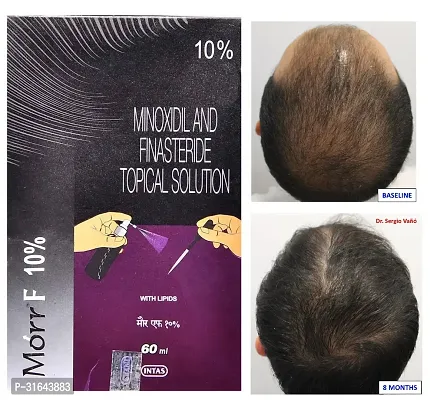 Minoxidil Hair Solution Serum-thumb0