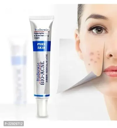 Imported product of USA. Absolutely Branded Outcome. No Replicas, counterfeit items, and imitations. BIOAQUA PURE SKIN -Removal of Acne, Acne Scars, Shrink Pores, Oil Control, Acne Rejuvenation  Mois-thumb0