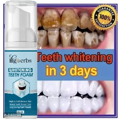 Teeth Foam for Whitening Treatment