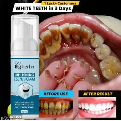 Teeth Foam for Whitening Treatment 60ml