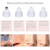 Acne Pimple Pore Cleaner Vacuum tools-thumb2