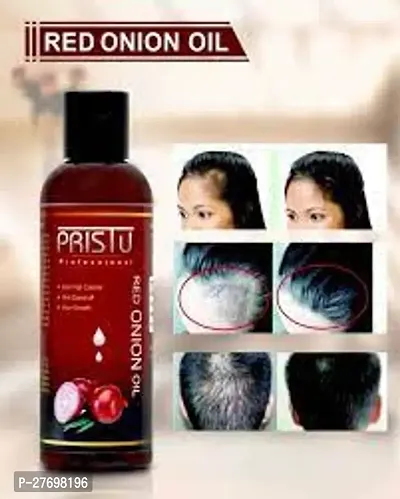 Red Onion Hair Oil-thumb0