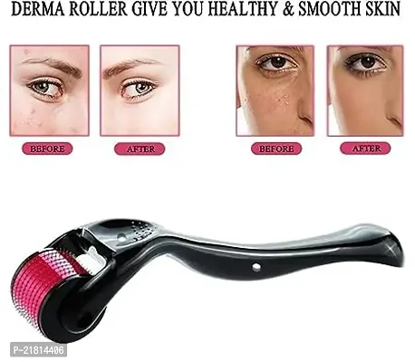 Best Effective Derma Roller For Hair Growth 0.5 mm with 540 Titanium Needles | Repairs Damaged Hair, Activates Hair Follicles | For Hair Fall  Hair Thickening | Easy to Use-thumb3