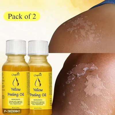 Yellow Peeling Oil Extra Strength For Body