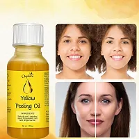 Yellow Peeling Oil Extra Strength For Body-thumb1